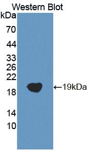 CLP / COTL1 Antibody - Western blot of CLP / COTL1 antibody.