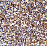 CLP / COTL1 Antibody - Formalin-fixed and paraffin-embedded human spleen tissue reacted with COTL1 Antibody , which was peroxidase-conjugated to the secondary antibody, followed by DAB staining. This data demonstrates the use of this antibody for immunohistochemistry; clinical relevance has not been evaluated.
