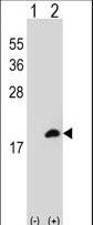 CLP / COTL1 Antibody - Western blot of COTL1 (arrow) using rabbit polyclonal COTL1 Antibody. 293 cell lysates (2 ug/lane) either nontransfected (Lane 1) or transiently transfected (Lane 2) with the COTL1 gene.