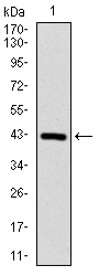 CLP / COTL1 Antibody - Western blot using COTL1 monoclonal antibody against human COTL1 (AA: 1-142) recombinant protein. (Expected MW is 16 kDa)