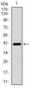 CLP / COTL1 Antibody - Western blot using COTL1 monoclonal antibody against human COTL1 (AA: 1-142) recombinant protein. (Expected MW is 16 kDa)