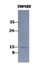 CLP / COTL1 Antibody - The SW480 cell lysates (40ug) were resolved by SDS-PAGE, transferred to PVDF membrane and probed with anti-human COTL1 antibody (1:1000). Proteins were visualized using a goat anti-mouse secondary antibody conjugated to HRP and an ECL detection system. The Cell lysates (20ug) were resolved by SDS-PAGE, transferred to PVDF membrane and probed with anti-human COTL1 antibody (1:2000). Proteins were visualized using a goat anti-mouse secondary antibody conjugated to HRP and an ECL detection system. Lane 1.: 293T cell lysate Lane 2.: COTL1 transfected 293T cell lysate The Cell lysates (40ug) were resolved by SDS-PAGE, transferred to PVDF membrane and probed with anti-human COTL1 antibody (1:500). Proteins were visualized using a goat anti-mouse secondary antibody conjugated to HRP and an ECL detection system. Lane 1.: PC3 cell lysate Lane 2.: A549 cell lysate Lane 3.: U87-MG cell lysate Lane 4.: HeLa cell lysate