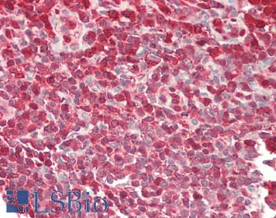 CLP / COTL1 Antibody - Human Tonsil: Formalin-Fixed, Paraffin-Embedded (FFPE).  This image was taken for the unconjugated form of this product. Other forms have not been tested.