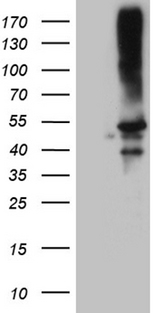 CLP1 Antibody - HEK293T cells were transfected with the pCMV6-ENTRY control. (Left lane) or pCMV6-ENTRY CLP1. (Right lane) cDNA for 48 hrs and lysed