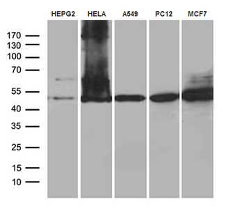 CLP1 Antibody - Western blot analysis of extracts. (35ug) from 5 cell lines by using anti-CLP1 monoclonal antibody. (1:500)
