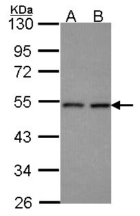 CLP1 Antibody - Sample (30 ug of whole cell lysate). A: Hela, B: Hep G2 . 10% SDS PAGE. CLP1 antibody diluted at 1:1000.