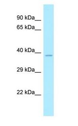 CLP1 Antibody - CLP1 antibody Western Blot of RPMI-8226.  This image was taken for the unconjugated form of this product. Other forms have not been tested.