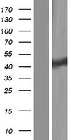 CLP1 Protein - Western validation with an anti-DDK antibody * L: Control HEK293 lysate R: Over-expression lysate