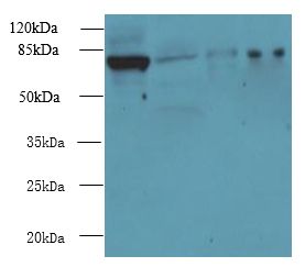 CLPB Antibody - Western blot. All lanes: CLPB antibody at 5 ug/ml. Lane 1: 293T whole cell lysate. Lane 2: Mouse brain tissue. Lane 3: COLO205 whole cell lysate. Lane 4: MCF7 whole cell lysate. Secondary Goat polyclonal to Rabbit IgG at 1:10000 dilution. Predicted band size: 79 kDa. Observed band size: 79 kDa.