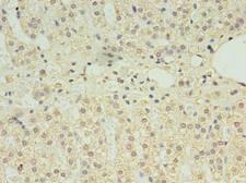 CLPB Antibody - Immunohistochemistry of paraffin-embedded human adrenal gland tissue using antibody at dilution of 1:100.