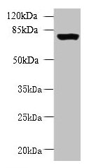 CLPB Antibody - Western blot All lanes: CLPB antibody at 5µg/ml + 293T whole cell lysate Secondary Goat polyclonal to rabbit IgG at 1/10000 dilution Predicted band size: 79, 76, 73, 75, 58 kDa Observed band size: 79 kDa