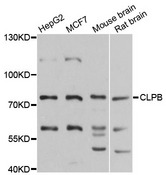 CLPB Antibody - Western blot analysis of extracts of various cell lines.