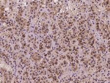 CLPB Antibody - Immunochemical staining of human CLPB in human adrenal gland with rabbit polyclonal antibody at 1:100 dilution, formalin-fixed paraffin embedded sections.
