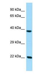 CLPP Antibody - CLPP antibody Western Blot of 293T.  This image was taken for the unconjugated form of this product. Other forms have not been tested.
