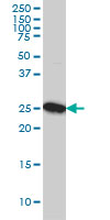 CLPP Antibody - CLPP monoclonal antibody (M01), clone 3E2 Western blot of CLPP expression in A-431.