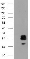 CLPP Antibody - HEK293T cells were transfected with the pCMV6-ENTRY control (Left lane) or pCMV6-ENTRY CLPP (Right lane) cDNA for 48 hrs and lysed. Equivalent amounts of cell lysates (5 ug per lane) were separated by SDS-PAGE and immunoblotted with anti-CLPP.