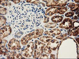 CLPP Antibody - IHC of paraffin-embedded Human Kidney tissue using anti-CLPP mouse monoclonal antibody.