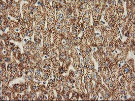 CLPP Antibody - IHC of paraffin-embedded Human liver tissue using anti-CLPP mouse monoclonal antibody.