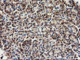 CLPP Antibody - IHC of paraffin-embedded Human pancreas tissue using anti-CLPP mouse monoclonal antibody.
