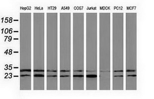CLPP Antibody - Western blot analysis of extracts (35ug) from 9 different cell lines by using anti-CLPP monoclonal antibody.