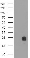 CLPP Antibody - HEK293T cells were transfected with the pCMV6-ENTRY control (Left lane) or pCMV6-ENTRY CLPP (Right lane) cDNA for 48 hrs and lysed. Equivalent amounts of cell lysates (5 ug per lane) were separated by SDS-PAGE and immunoblotted with anti-CLPP.