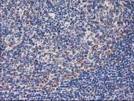 CLPP Antibody - IHC of paraffin-embedded Human lymph node tissue using anti-CLPP mouse monoclonal antibody. (Heat-induced epitope retrieval by 10mM citric buffer, pH6.0, 100C for 10min).