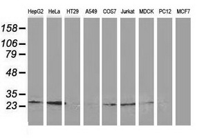 CLPP Antibody - Western blot of extracts (35ug) from 9 different cell lines by using anti-CLPP monoclonal antibody (HepG2: human; HeLa: human; SVT2: mouse; A549: human; COS7: monkey; Jurkat: human; MDCK: canine; PC12: rat; MCF7: human).
