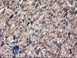 CLPP Antibody - IHC of paraffin-embedded Human liver tissue using anti-CLPP mouse monoclonal antibody. (Heat-induced epitope retrieval by 10mM citric buffer, pH6.0, 100C for 10min).