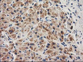 CLPP Antibody - IHC of paraffin-embedded Human Ovary tissue using anti-CLPP mouse monoclonal antibody. (Heat-induced epitope retrieval by 10mM citric buffer, pH6.0, 100C for 10min).