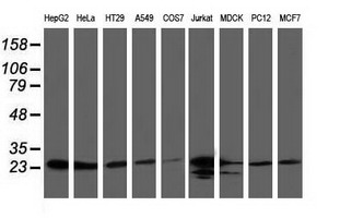 CLPP Antibody - Western blot of extracts (35 ug) from 9 different cell lines by using anti-CLPP monoclonal antibody.
