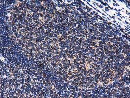 CLPP Antibody - IHC of paraffin-embedded Human lymph node tissue using anti-CLPP mouse monoclonal antibody.