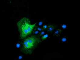 CLPP Antibody - Anti-CLPP mouse monoclonal antibody immunofluorescent staining of COS7 cells transiently transfected by pCMV6-ENTRY CLPP.