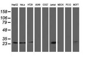 CLPP Antibody - Western blot of extracts (35 ug) from 9 different cell lines by using anti-CLPP monoclonal antibody.
