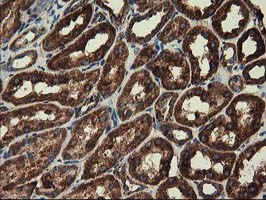 CLPP Antibody - IHC of paraffin-embedded Human Kidney tissue using anti-CLPP mouse monoclonal antibody.