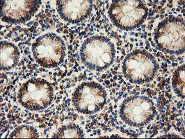 CLPP Antibody - IHC of paraffin-embedded Human colon tissue using anti-CLPP mouse monoclonal antibody.