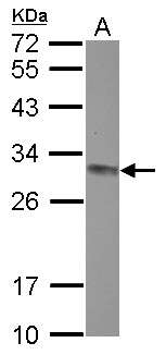 CLPP Antibody - Sample (30 ug of whole cell lysate) A: Jurkat 12% SDS PAGE CLPP antibody diluted at 1:1000