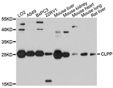 CLPP Antibody - Western blot analysis of extracts of various cells.