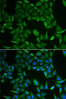 CLPS / Colipase Antibody - Immunofluorescence analysis of HeLa cells.
