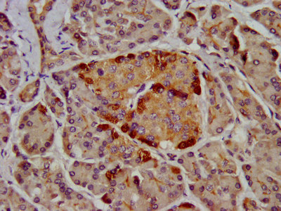 CLPS / Colipase Antibody - Immunohistochemistry image at a dilution of 1:400 and staining in paraffin-embedded human pancreatic tissue performed on a Leica BondTM system. After dewaxing and hydration, antigen retrieval was mediated by high pressure in a citrate buffer (pH 6.0) . Section was blocked with 10% normal goat serum 30min at RT. Then primary antibody (1% BSA) was incubated at 4 °C overnight. The primary is detected by a biotinylated secondary antibody and visualized using an HRP conjugated SP system.