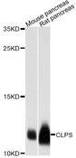 CLPS / Colipase Antibody - Western blot analysis of extracts of various cell lines, using CLPS antibody at 1:3000 dilution. The secondary antibody used was an HRP Goat Anti-Rabbit IgG (H+L) at 1:10000 dilution. Lysates were loaded 25ug per lane and 3% nonfat dry milk in TBST was used for blocking. An ECL Kit was used for detection and the exposure time was 10s.
