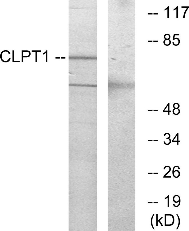 CLPTM1 Antibody - Western blot analysis of lysates from COS7 cells, using CLPT1 Antibody. The lane on the right is blocked with the synthesized peptide.