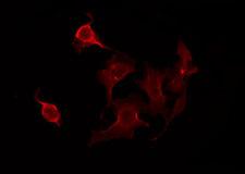 CLPTM1 Antibody - Staining HeLa cells by IF/ICC. The samples were fixed with PFA and permeabilized in 0.1% Triton X-100, then blocked in 10% serum for 45 min at 25°C. The primary antibody was diluted at 1:200 and incubated with the sample for 1 hour at 37°C. An Alexa Fluor 594 conjugated goat anti-rabbit IgG (H+L) Ab, diluted at 1/600, was used as the secondary antibody.