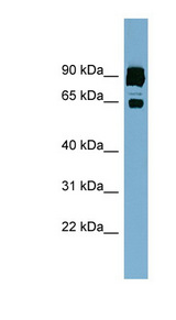 CLPTM1L / CLPTM1-Like Antibody - CLPTM1L antibody western blot of ACHN lysate.  This image was taken for the unconjugated form of this product. Other forms have not been tested.