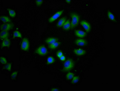 CLPTM1L / CLPTM1-Like Antibody - Immunofluorescence staining of A549 cells at a dilution of 1:266, counter-stained with DAPI. The cells were fixed in 4% formaldehyde, permeabilized using 0.2% Triton X-100 and blocked in 10% normal Goat Serum. The cells were then incubated with the antibody overnight at 4°C.The secondary antibody was Alexa Fluor 488-congugated AffiniPure Goat Anti-Rabbit IgG (H+L) .
