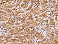 CLPX Antibody - Immunochemical staining of human CLPX in human kidney with rabbit polyclonal antibody at 1:100 dilution, formalin-fixed paraffin embedded sections.