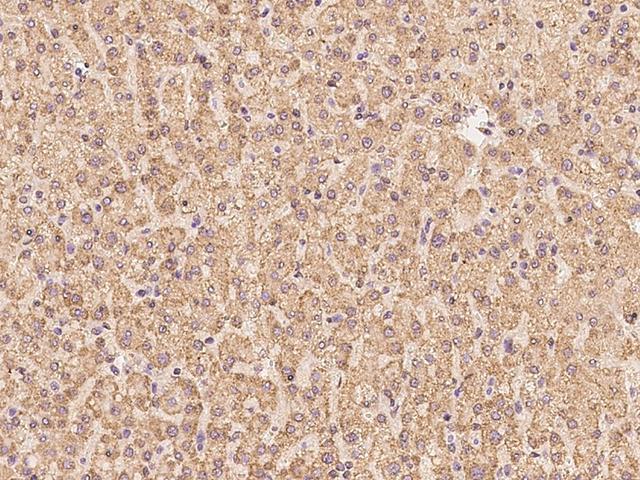 CLPX Antibody - Immunochemical staining of human CLPX in human liver with rabbit polyclonal antibody at 1:100 dilution, formalin-fixed paraffin embedded sections.