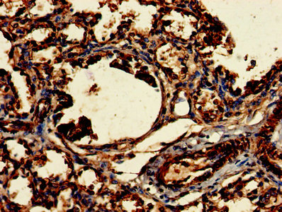 CLRN2 Antibody - Immunohistochemistry of paraffin-embedded human liver tissue using CLRN2 Antibody at dilution of 1:100