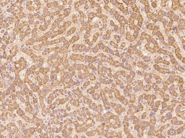 CLRN2 Antibody - Immunochemical staining of human CLRN2 in human liver with rabbit polyclonal antibody at 1:100 dilution, formalin-fixed paraffin embedded sections.
