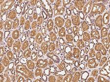 CLRN3 Antibody - Immunochemical staining of human CLRN3 in human kidney with rabbit polyclonal antibody at 1:500 dilution, formalin-fixed paraffin embedded sections.