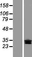 CLRN3 Protein - Western validation with an anti-DDK antibody * L: Control HEK293 lysate R: Over-expression lysate